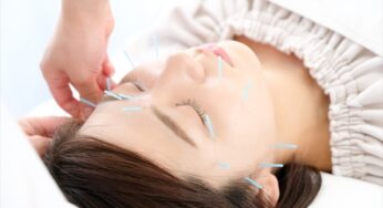 美容鍼で顔のメンテ!夏でも乾燥は敵!おすすめ化粧水スプレーと円皮鍼!